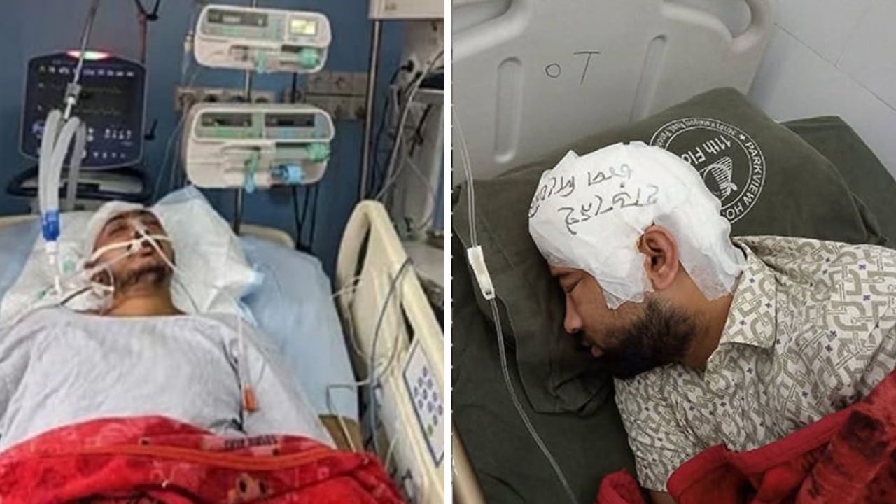 চবিতে শিক্ষার্থী-স্থানীয় সংঘর্ষ: মামুনের মাথার খুলি রাখা হয়েছে ফ্রিজে, সায়েম এখনও অচেতন